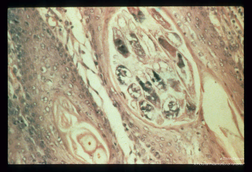 Section through dog's skin.