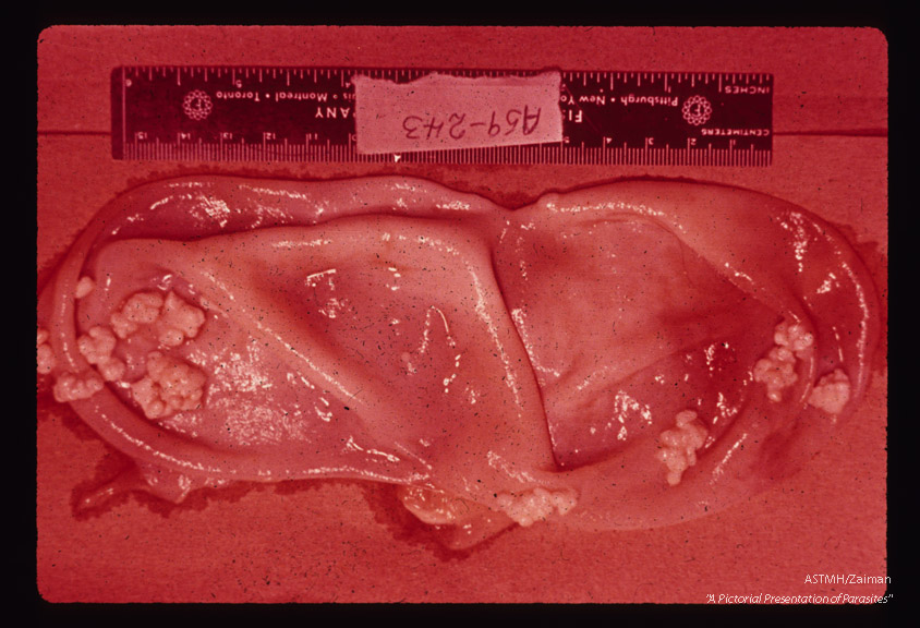 Inner surface of the cyst in number 578.