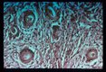 Cross section of adults in bowel.