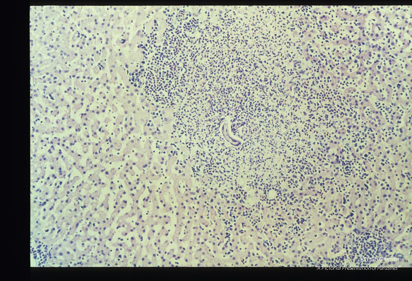 Typical hepatic granuloma containing a larva. Natural infection in a cat.