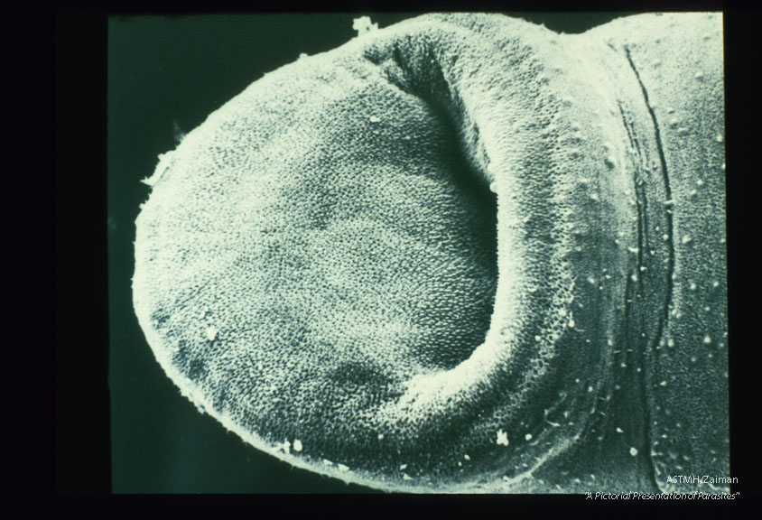 SEM showing mouth.