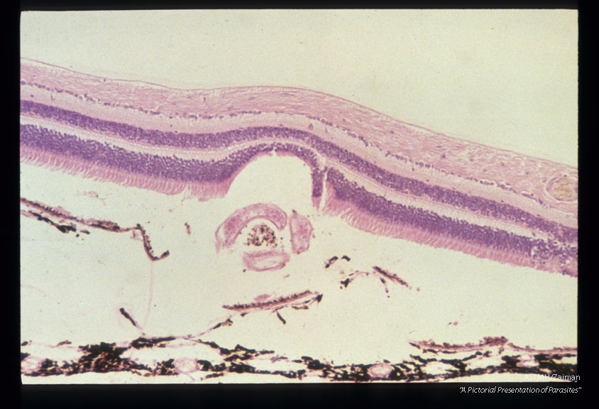 Subretinal hemorrhage in experimentally infected squirrel monkey.