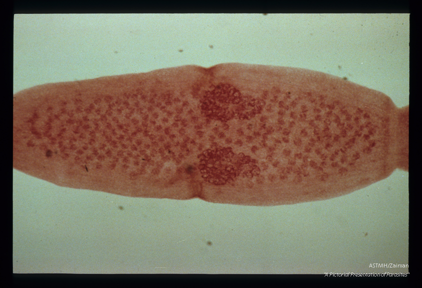 Gravid proglottid again showing the double set of genital organs. The masses within the proglottids are groups of eggs.