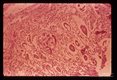 Cross section through adults in human bowel.