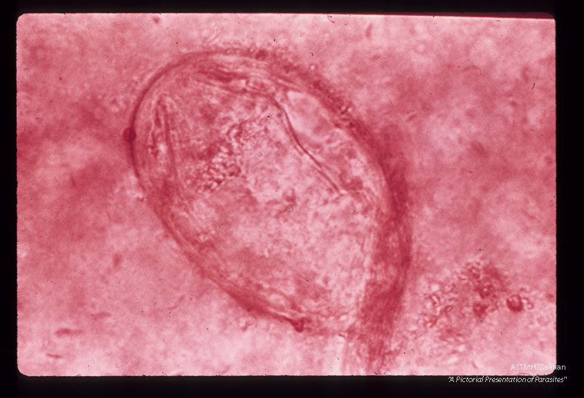 Egg in stool. Small lateral spine visible.