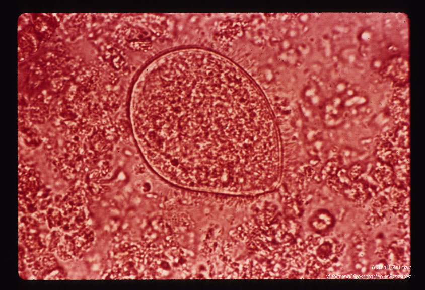 Trophozoite, iodine stain showing cilia.