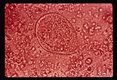 Trophozoite, iodine stain showing cilia.