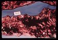 Trichuris tichiura, Balantidium coli,Entamoeba histolytica. Autopsy specimen showing adult helminths, ulcerations and bloody intestinal contents.