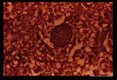 Cyst in human brain. Wilder's silver impregnation.