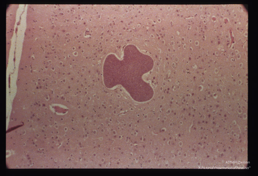 Hematoxylin-eosin stained sections of mouse brain.