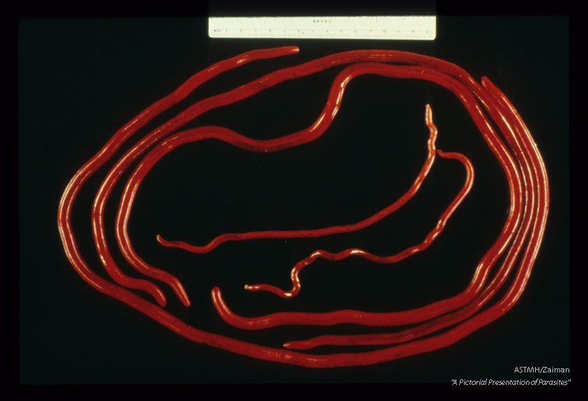 Large adult taken from the peritoneal cavity of a dog.