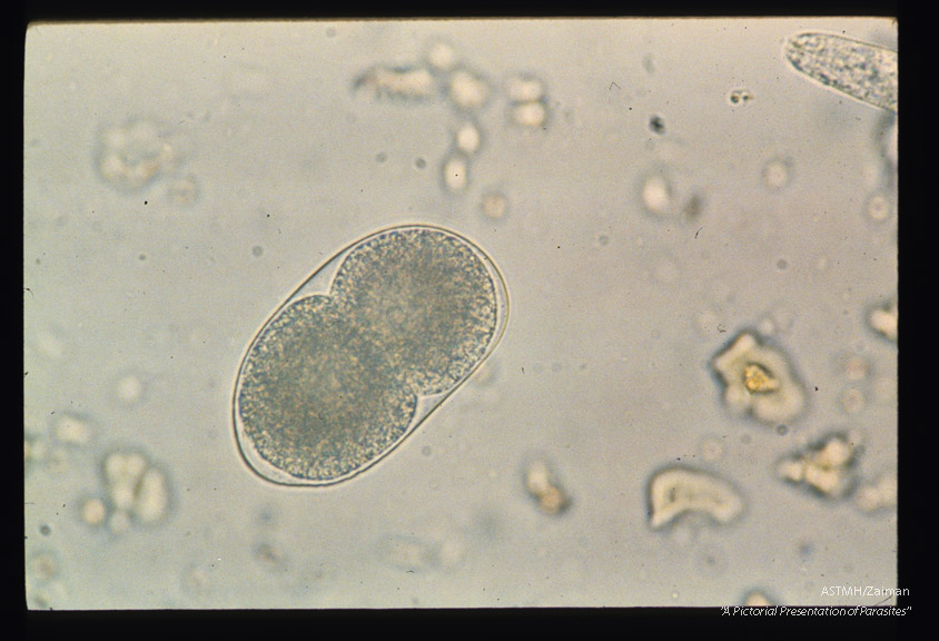 Sequence showing development of larva in egg.