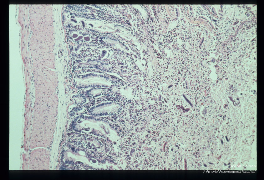 Jejunitis induced by experimental infection in Erythrocebus patas.