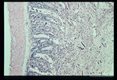 Jejunitis induced by experimental infection in Erythrocebus patas.