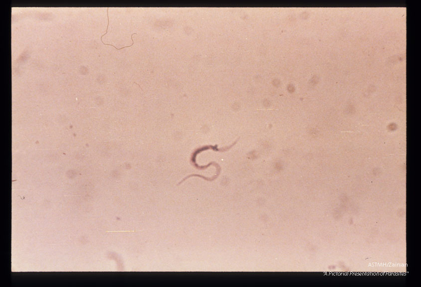 Long slender form in supernatant of infected Hela cell culture. Peru straia.