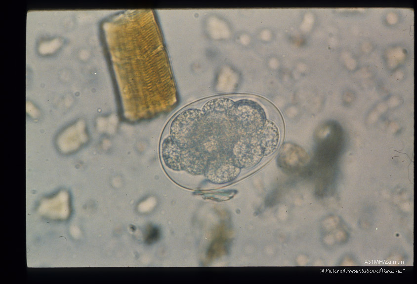 Sequence showing development of larva in egg.