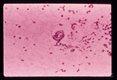 Cross section through larva found in pleural effusion of patient in Mt. Kisco, New York.