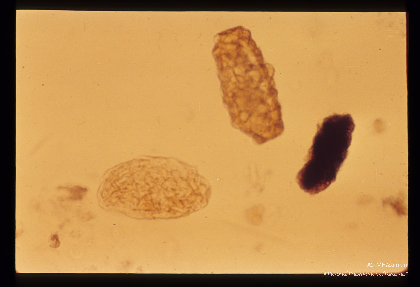 Infertile egg, mamillated and distorted, being more elongate and rectangular than normal.