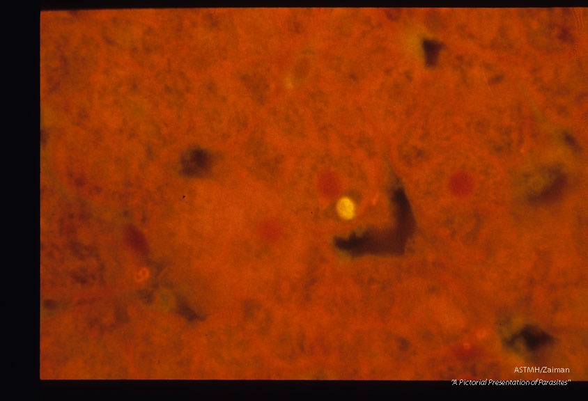 Demonstration of hypnozoiite and hepatic schizonts by immunof lucres cent antibodies and subsequent counterstaining by Giemaa-colophonium.