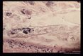 Dog mite in a human hair follicle.