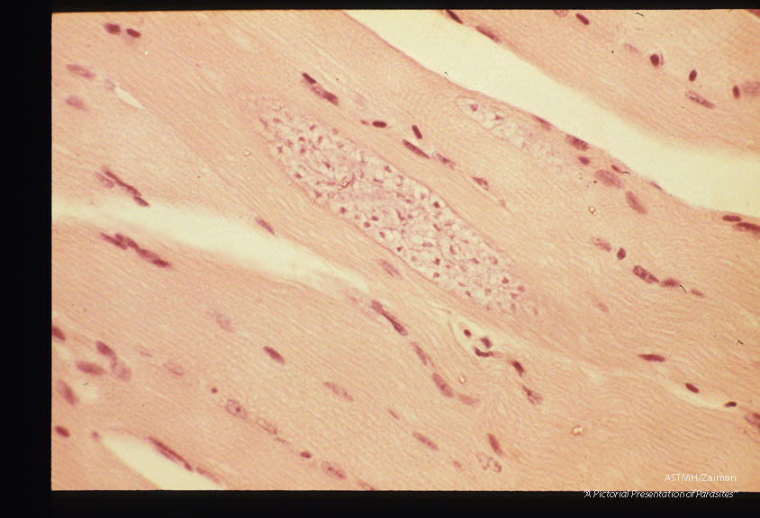 Cysts in leg muscle of budgerigar. 6 weeks PI. Low and high magnifications.