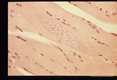 Cysts in leg muscle of budgerigar. 6 weeks PI. Low and high magnifications.