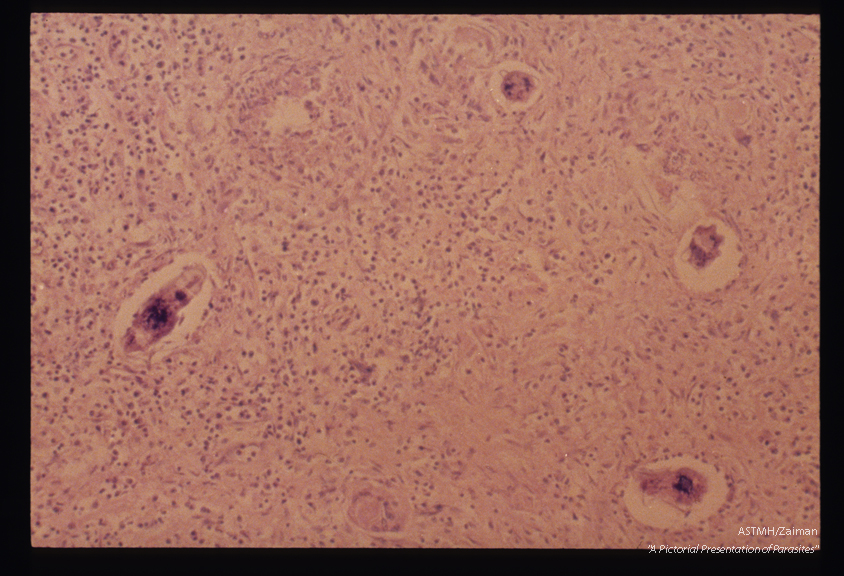 Eggs in a plexus of nerves within the neck.