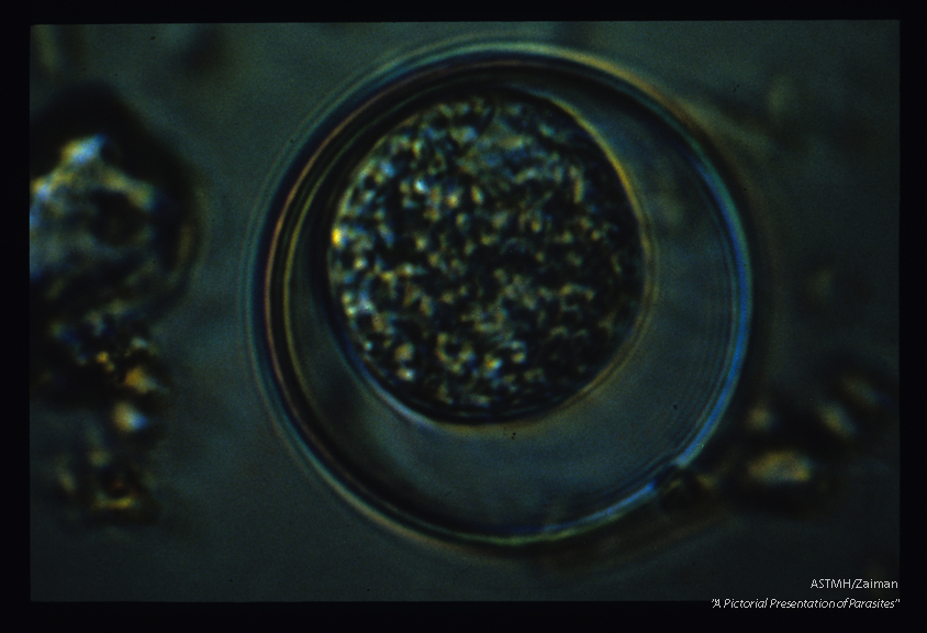 Oocyst with undivided sporoblast. This large coccidian from the cat measures approximately thirty microns in diameter.