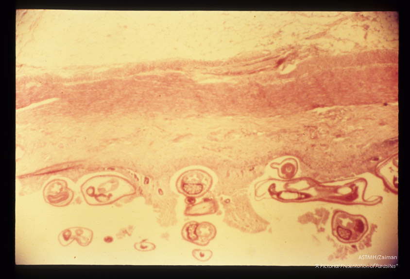 Low power view of dog intestine, showing multiple sections thru adult worms. See slides 7 and 8.