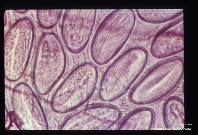 Egg at various magnifications. In the highest power, the embryo is seen.