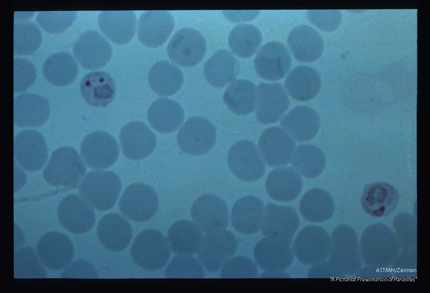 Early trophozoite and ring(?) with double chromatin dots.