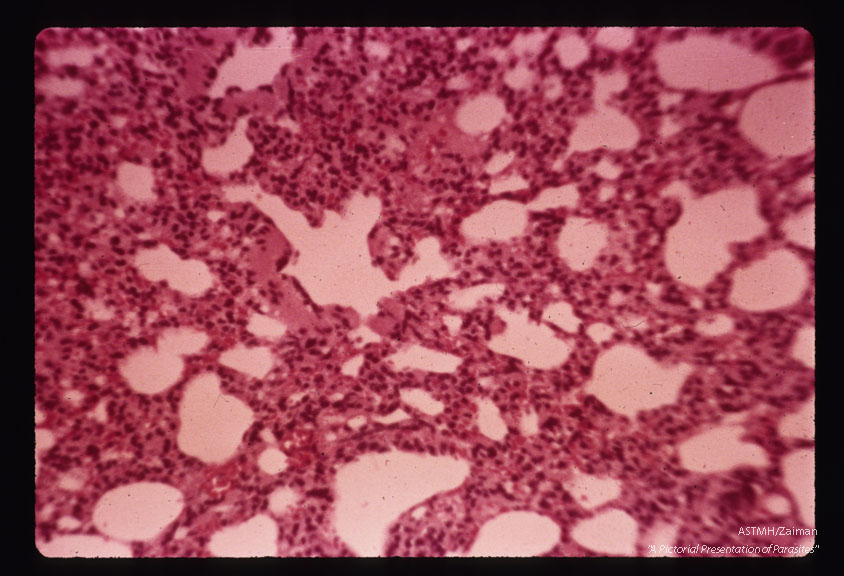 Microfilaria in dog lung.