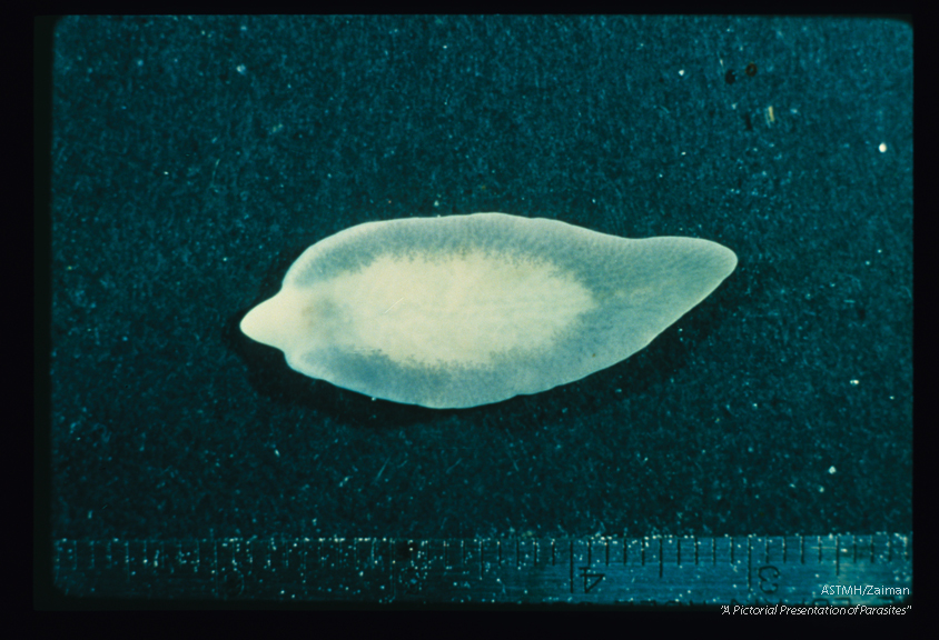 Dorsal view of formalin fixed unstained adult. The anterior cone is readily seen in this and the following specimen. Compare this with slide number 57.
