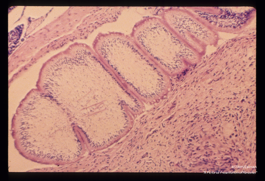 Experimental sparganum infection in a rat. A high power longitudinal section through a portion of a single worm reveals structural detail.
