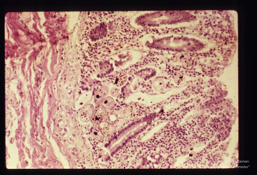 Trophozoites within intestinal wall.