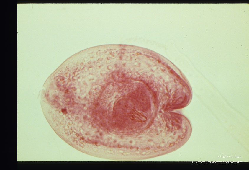 Cysticercus digested free of muscle. Note hooks on protoscolex. Whole mount. Carmine stain.