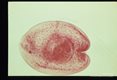 Cysticercus digested free of muscle. Note hooks on protoscolex. Whole mount. Carmine stain.