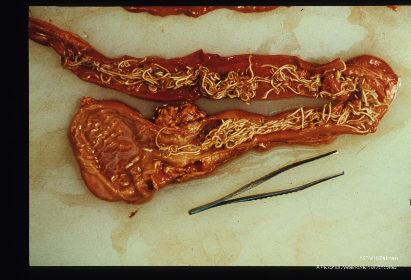 Adults in the terminal ileum and caecum.