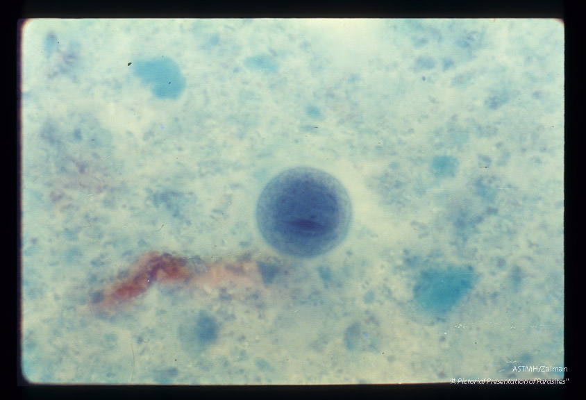 Cyst in stool with splinter-like chromatoidal body . Trichrome stain.