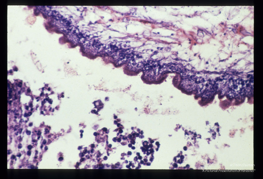 Multiple sections showing membranes, suckers and hooks.