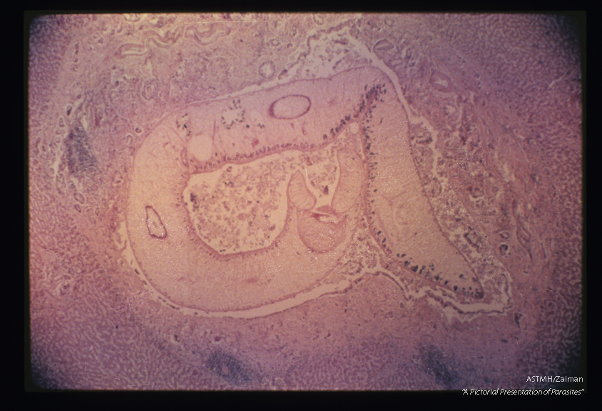 Liver. This is a higher power of the material seen in slide number 9. Note that the section passes through the oral sucker and pharynx. The two more or less elliptical rings represent sections through the digestive ceca.