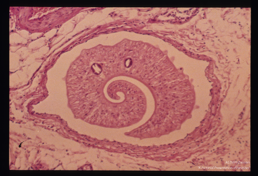 Adult male in mesoappendiceal vein. At this magnification the digestive ceca and cuticular tubercles are easily seen.