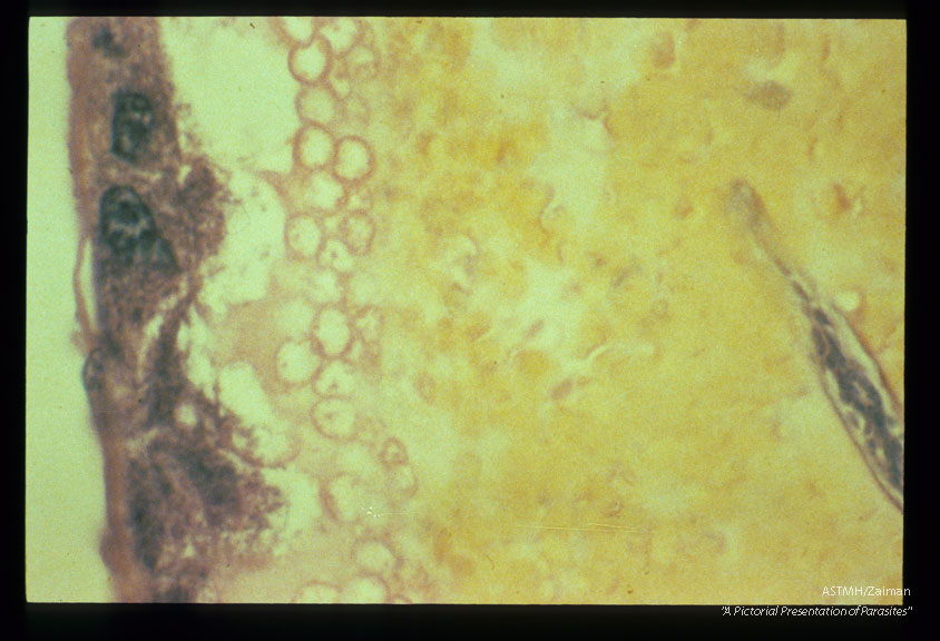 Microfilaria within the blood meal in the midgut of a. aegypti (H 4 E stained section).
