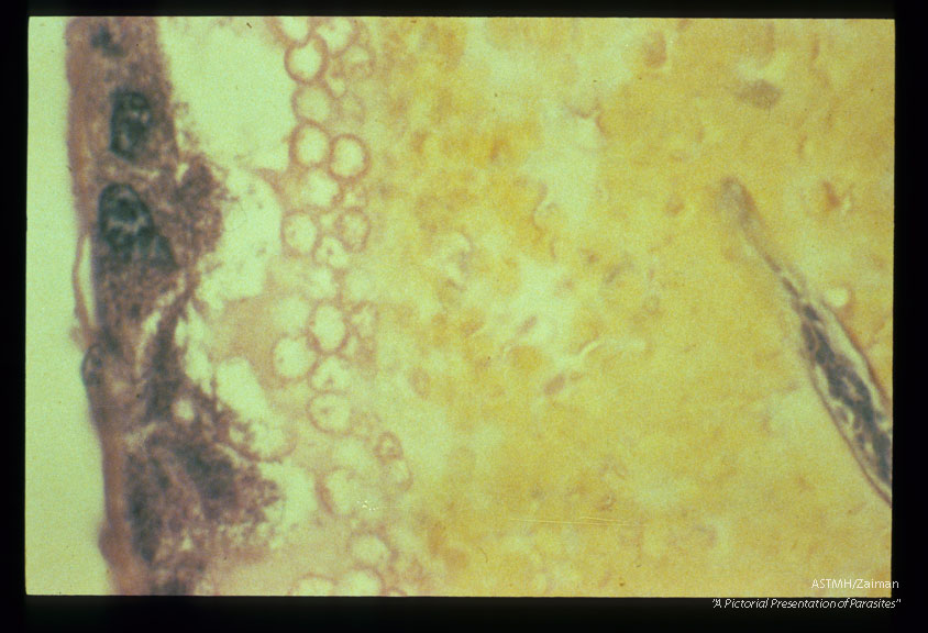 Microfilaria within the blood meal in the midgut of a. aegypti (H 4 E stained section).