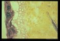 Microfilaria within the blood meal in the midgut of a. aegypti (H 4 E stained section).