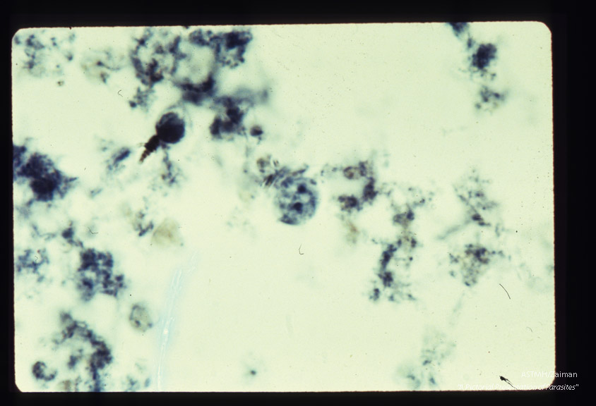 Trophozoite, iron hematoxylin stain. Binucleate form.