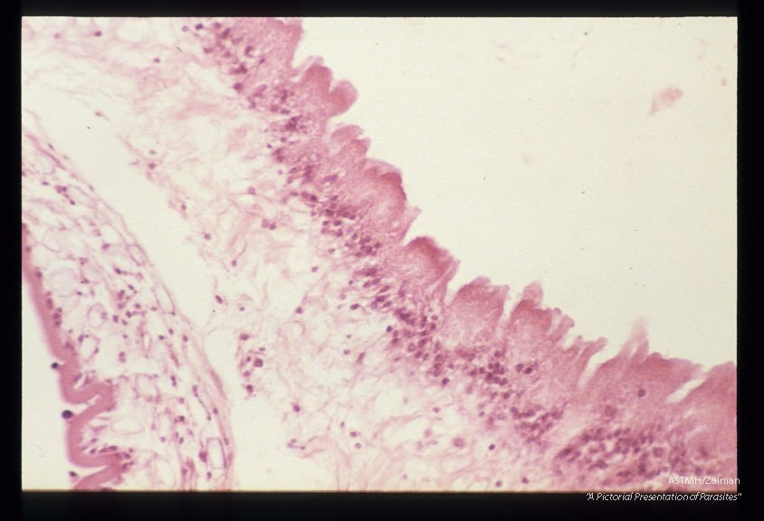 Multiple sections showing membranes, suckers and hooks.