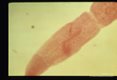 Adult worm.
