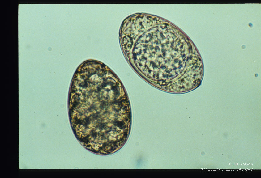 Two eggs, one undeveloped, the other containing a coracidium.