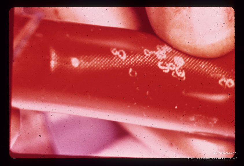 Adult schistosomes caught in blood filter.